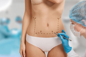 woman-marked-out-cosmetic-surgery
